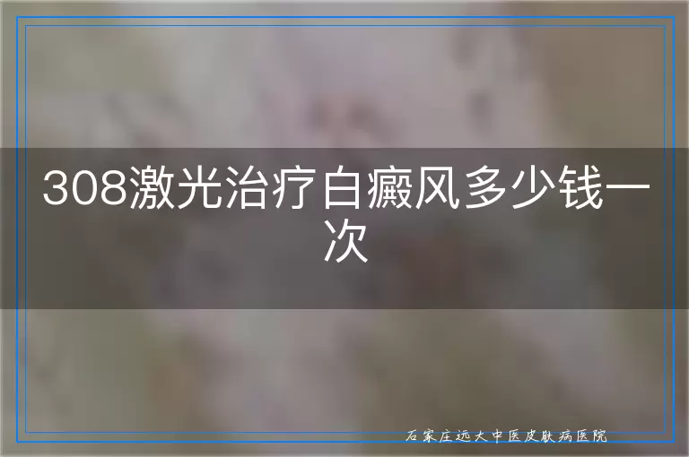 308激光治疗白癜风多少钱一次