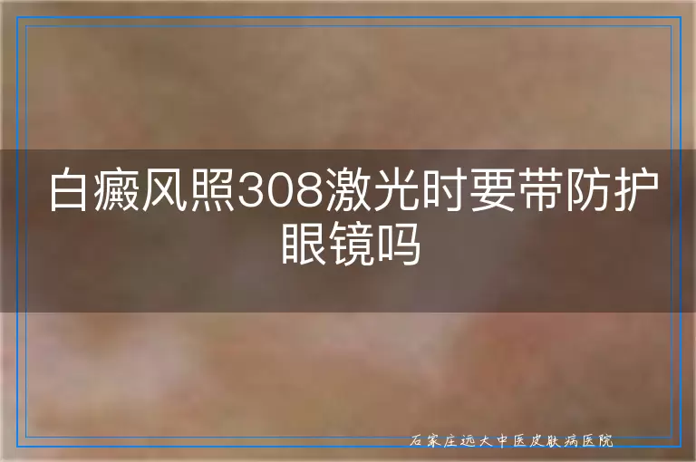 白癜风照308激光时要带防护眼镜吗