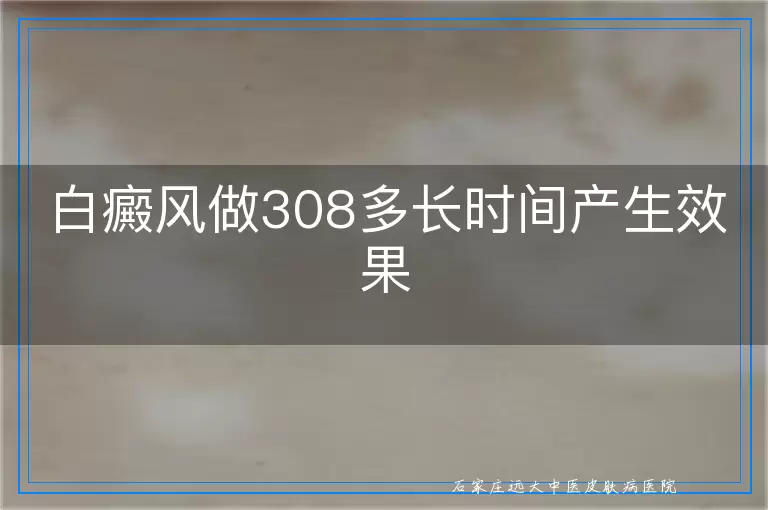 白癜风做308多长时间产生效果