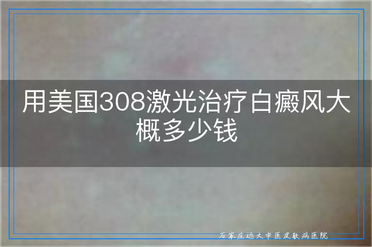 用美国308激光治疗白癜风大概多少钱