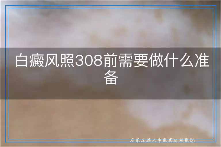 白癜风照308前需要做什么准备