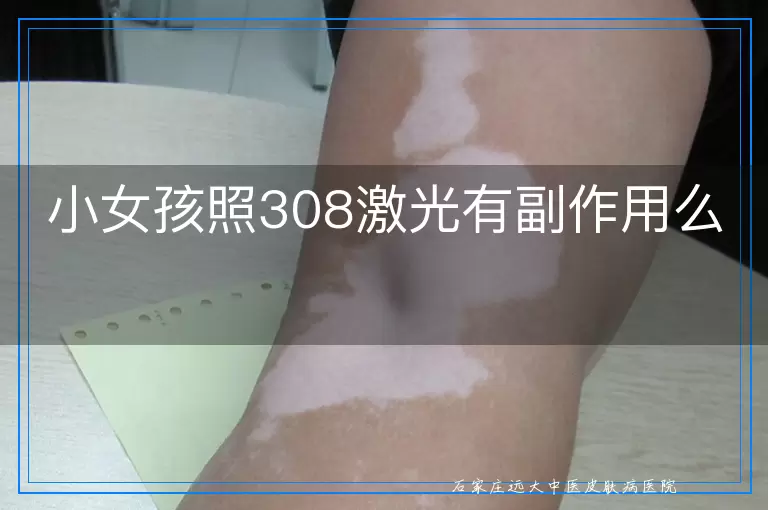 小女孩照308激光有副作用么