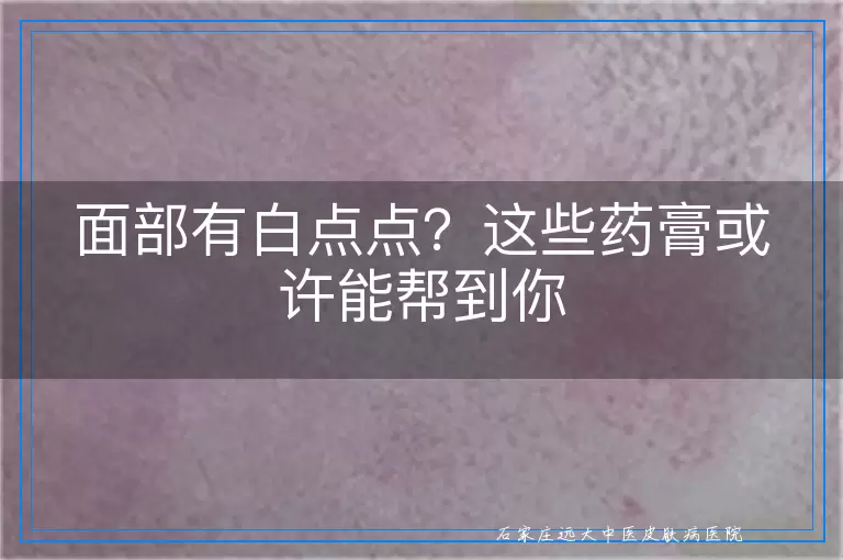 面部有白点点？这些药膏或许能帮到你