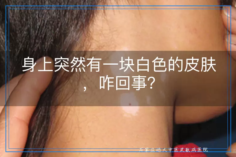 身上突然有一块白色的皮肤，咋回事？