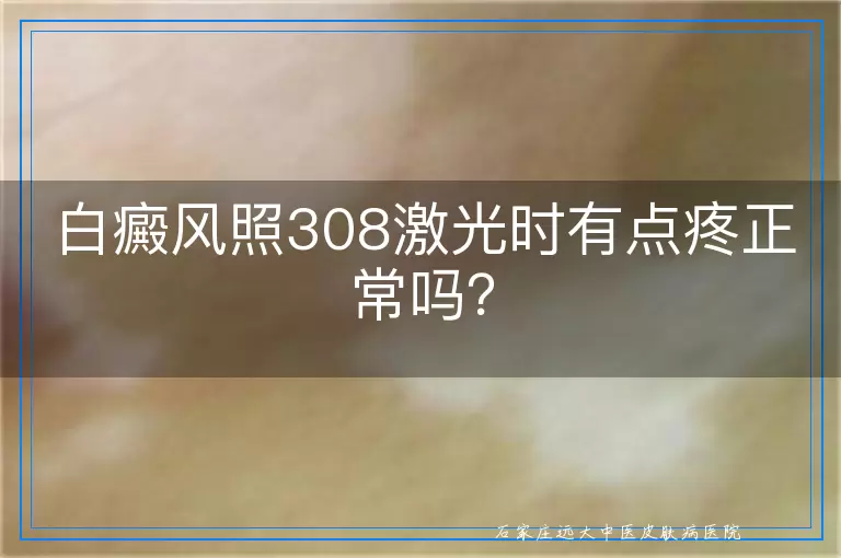 白癜风照308激光时有点疼正常吗？