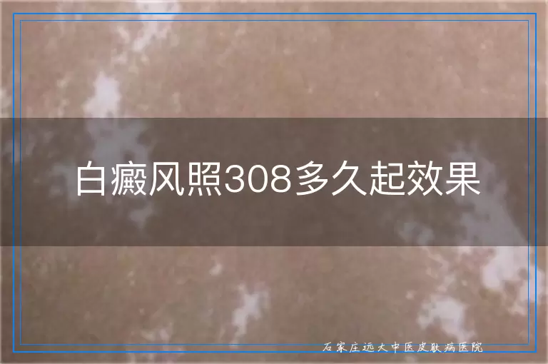 白癜风照308多久起效果