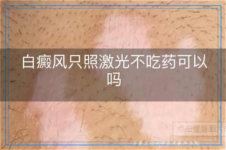 白癜风只照激光不吃药可以吗