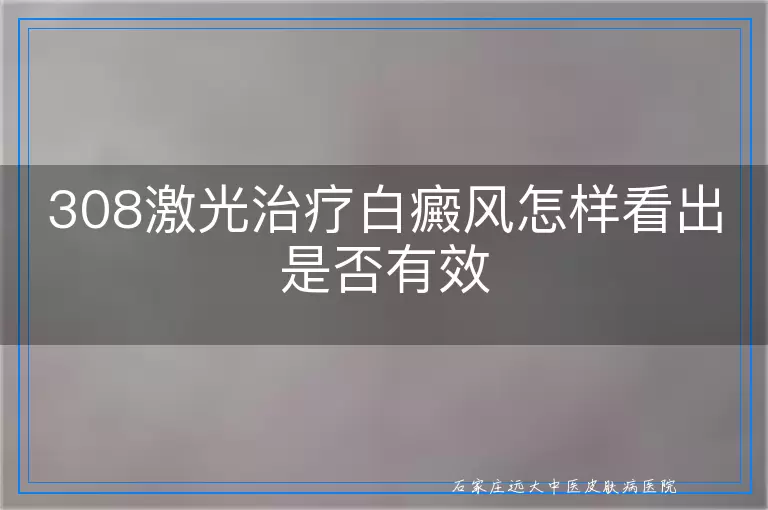 308激光治疗白癜风怎样看出是否有效