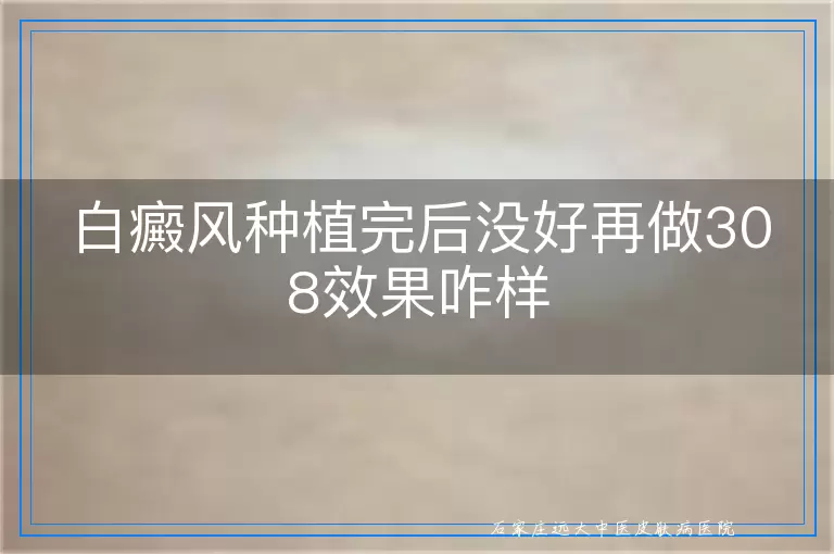 白癜风种植完后没好再做308效果咋样