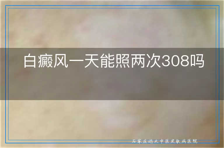 白癜风一天能照两次308吗