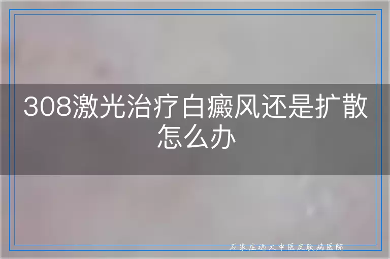 308激光治疗白癜风还是扩散怎么办