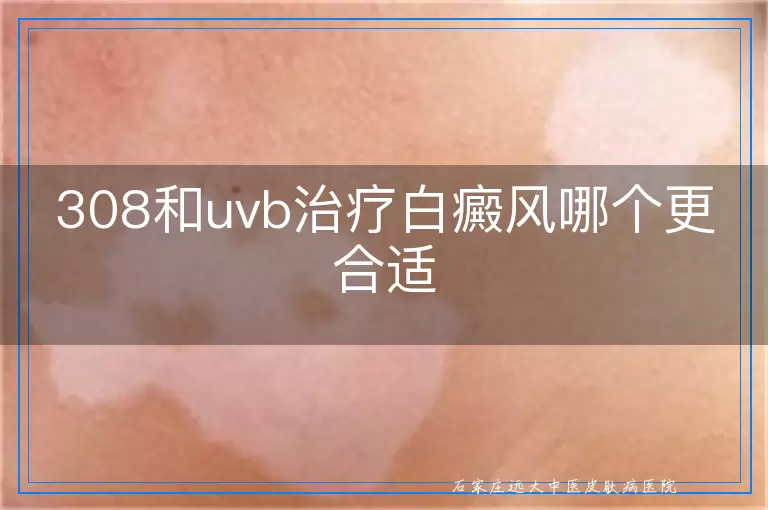 308和uvb治疗白癜风哪个更合适