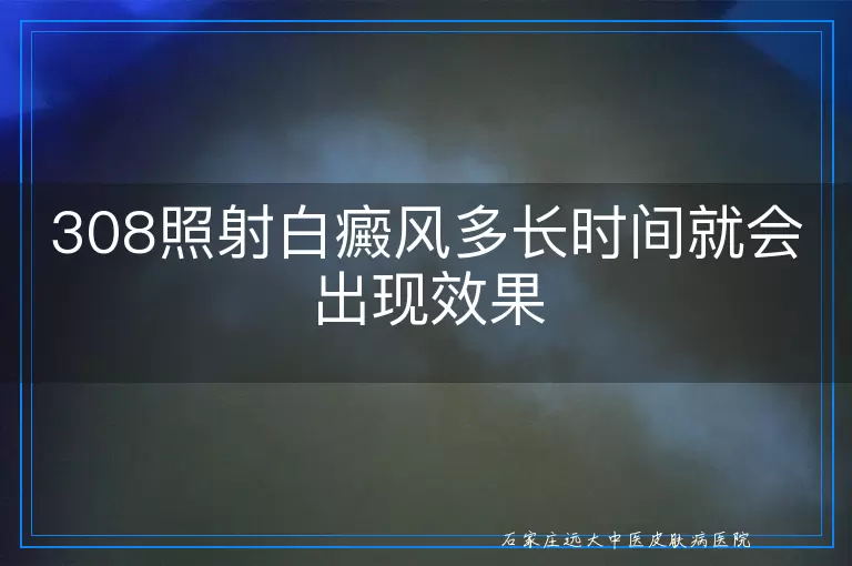 308照射白癜风多长时间就会出现效果