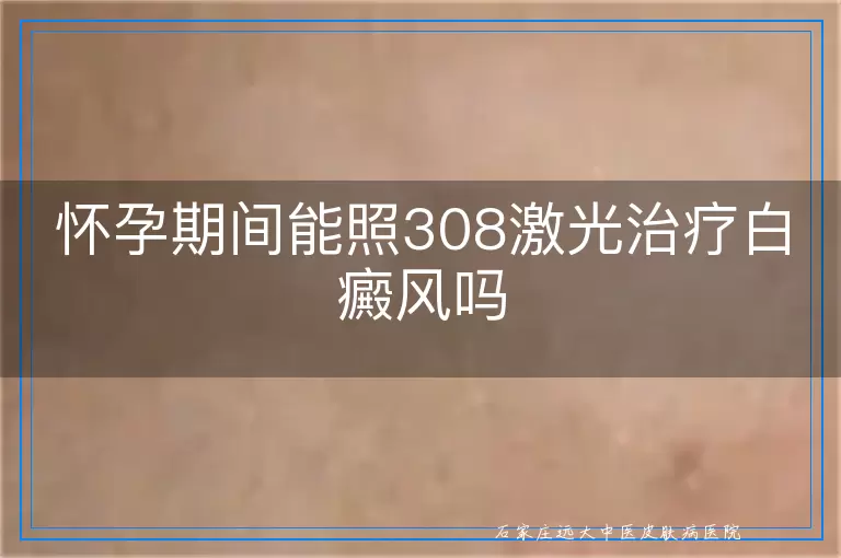 怀孕期间能照308激光治疗白癜风吗