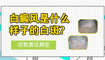 儿童胸部有白块照308激光多长时间有好转