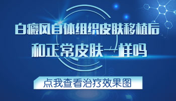 儿童胸部有白块照308激光多长时间有好转